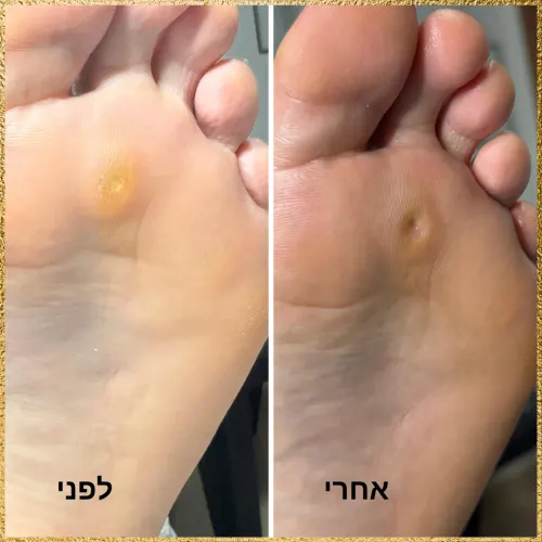 תיעוד טיפול מהקליניקה של הני קוסמטיקס